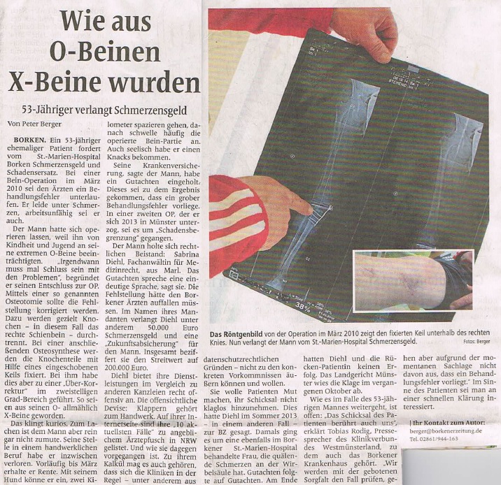 Borkener Zeitung vom 24.01.2015 Wie aus o Beinen X Beine wurden Schmerzensgeld Behandlungsfehler OP Ärztepfusch Entschädigung Sabrina Diehl Marl Oberhausen Medizinrecht