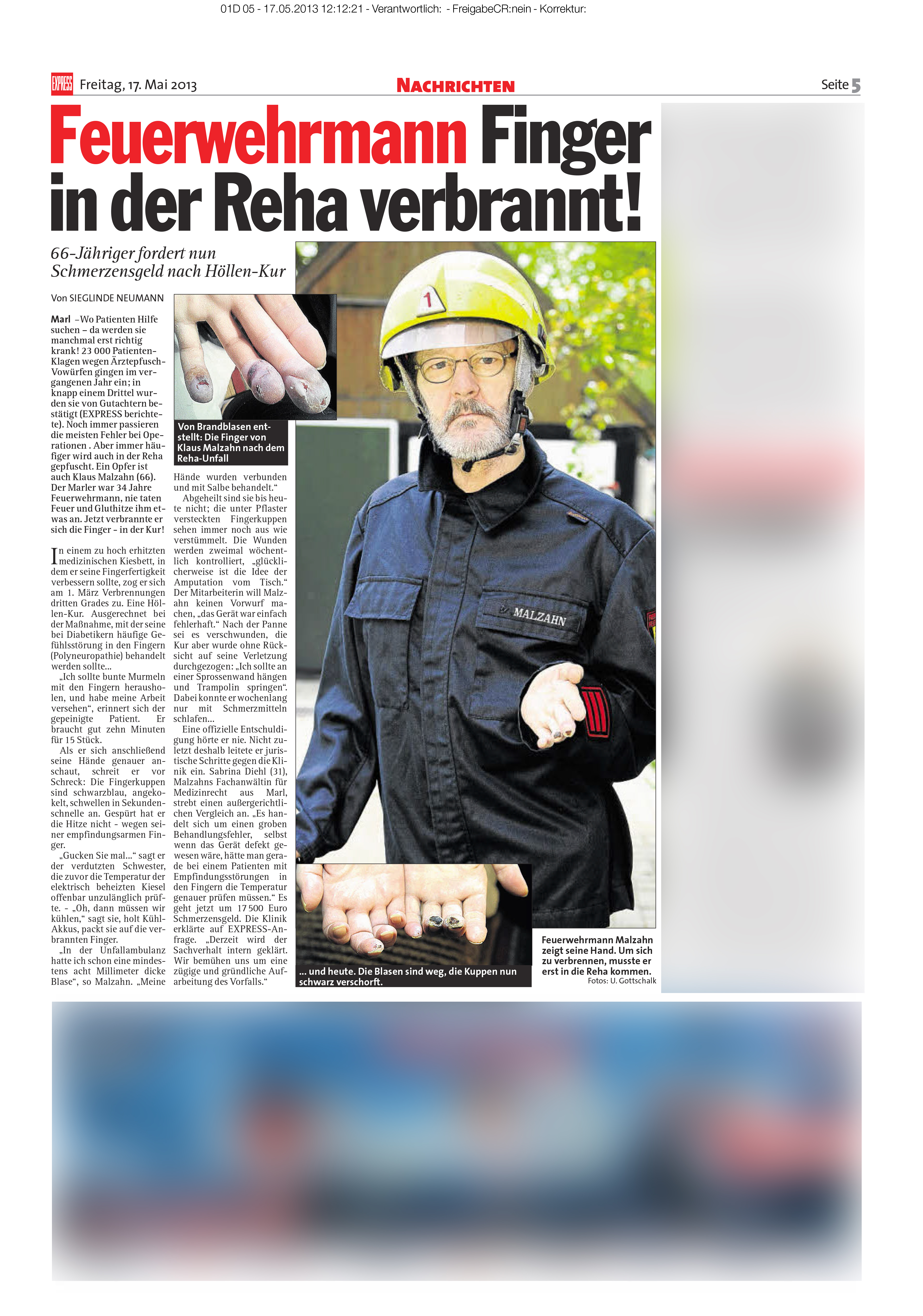 Express vom 17.05.2013 Feuerwehrmann Finger in der Reha verbrannt 66jähriger fordert nun Schmerzensgeld Sabrina Diehl Patientenanwalt Marl Pfusch Reha